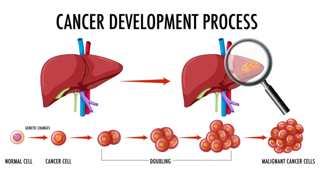 Estrogen's Protective Role Unveiled in Combatting Fatty Liver Disease and Liver Cancer